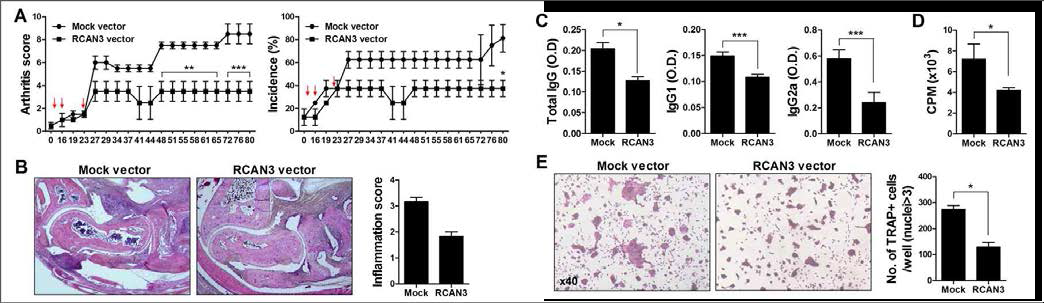 RCAN3 강화를 통한 류마티스관절염 발달 완화