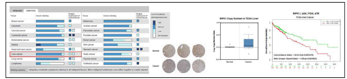 Bioinformatics tool을 이용한 간암에서 RIPK1의 발현 및 생존율 조사