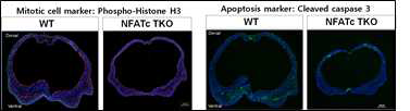 신경발생 phenotype 분석 예시 (marker immunostaining)