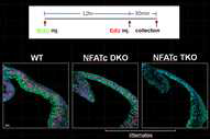 EdU-BrdU double labeling