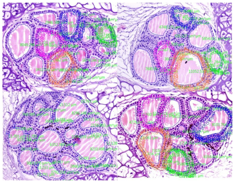 X. laevis 유생의 갑상선 조직에 대한 이미지 분석