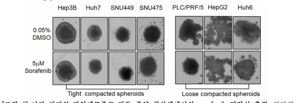 여러 가지의 간암세포주로 만든 종양 구상체에서의 sorafenib 민감성 측정.