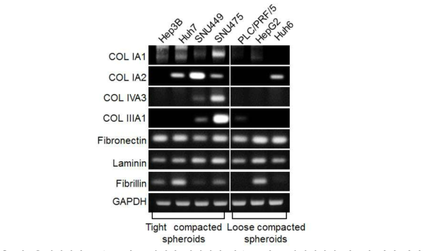 치밀성이 높은 종양 구상체와 치밀성이 낮은 종양 구상체에서의 세포외 기질 관련 유전자 발현 조사.