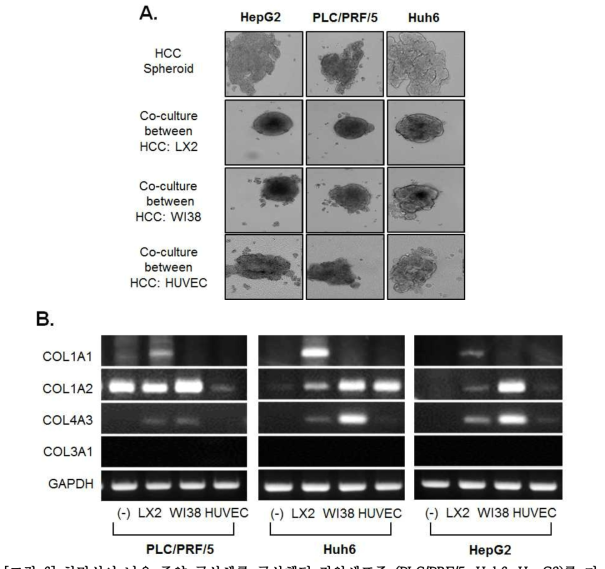 치밀성이 낮은 종양 구상체를 구상했던 간암세포주 (PLC/PRF/5, Huh6, HepG2)를 기 질세포와 혼합 배양하여 종양 구상체 형성 관찰 및 유전자 발현 분석.