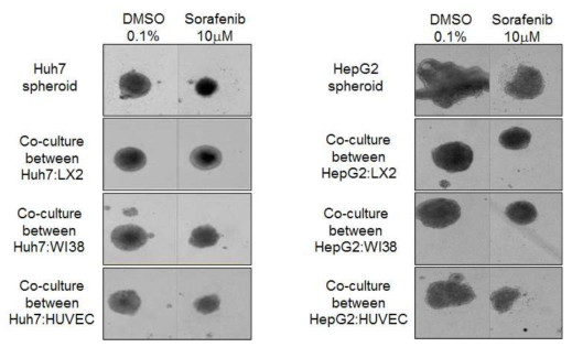 기질세포와 혼합 배양한 다세포성 종양 구상체의 sorafenib에 대한 민감성 분석.