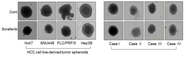 간암세포주(A)와 간암환자유래 간암세포(B)를 이용한 종양 구상체의 sofarenib에 대한 민감성 비교 분석.