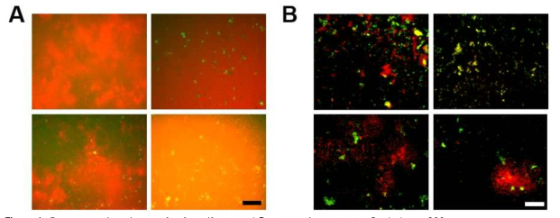 Representative pictures for A. artifacts and B. true active extracts. Scale bars: 200 µm