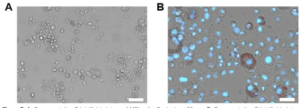 A. Representative Brightfield picture of MPI cells. Scale-bar, 50 μm. B. Representative Brightfield picture of MPI cells stained with DAPI (blue) and LipidTox (red) 4 days after plating in 384 well plates (50,000 cells / well).