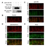 Pick1 repairs ephrinB1-induced disruption of AJs