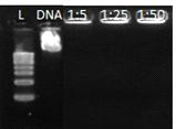 플라즈미드 DNA/폴리머의 컴플렉세이션.