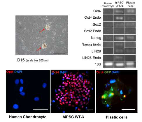 (왼쪽 위) 현미경으로 세포군집 형성 확인, (아래) Immunostaning image. (오른쪽 위) 역분화관련 유전자 확인.