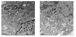 TEM 이용한 일반 섬유아세포(좌)와 GO-PEI가 들어간 섬유아세포(우) 비교.