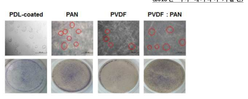 나노/FIBER 맴브레인에서 배아줄기세포의 배양 가능 확인