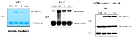 HSP27 단백질을 이용한 비정상 HSP27 dimerization 스크리닝에 의한 HSP27 저해제 J2발굴