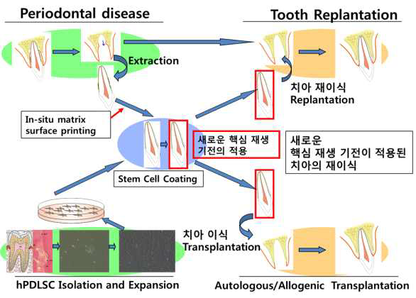 새로운 핵심 재생 기전이 적용된 치아 재이식 기법은 치주 질환의 해결 불가능한 난제를 극복할 해결 방안임