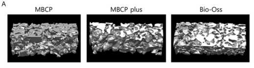 Micro-CT를 이용하여 hAMBSC의 carrier들의 pore size를 측 정하였을 때, pore의 특성은 상호 비슷하였음.