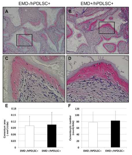 조직계측학적 분석을 통해 new cementum이 형성된 면적이 두 군(EMD-/hPDLSC+ group과 EMD+/hPDLSC+ group) 간에 유의차 없이 비슷하게 나타나는 것을 알 수 있다.
