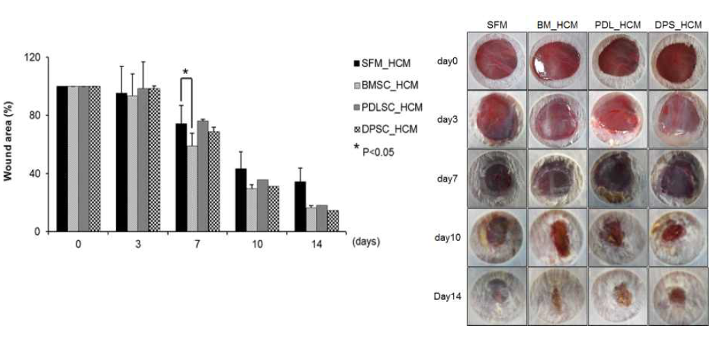 줄기세포 유래별 Hypoxia_CM의 치료 효과 차이를 분석하였을때, BMSC이 CM이 상처 치유 효과가 가장 우수하였음.