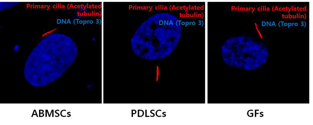 치성 줄기세포인 PDLSCs, ABMSCs, 그리고 GFs 에서 cilia가 뚜렷이 발현됨을 확인하였고 이에 대한 기능을 심도 있게 연구하고자 함.