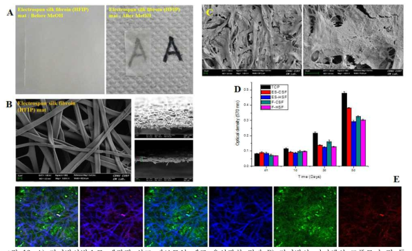 A) 전기방사법으로 제작된 실크 피브로인 매트 육안관찰 결과 B) 전기방사 지지체의 모폴로지 및 두께 C) 전기방사 실크 지지체에서 배양된 각막내피세포의 표현형 유지 D) 증식률 비교 (전기방사 지지체 vs. 필름) E) 전기방사 실크 지지체에서 배양된 각막내피세포의 기능성 단백질 발현 확인 (Red: ZO-1, Green:Na+/K+-ATPase)