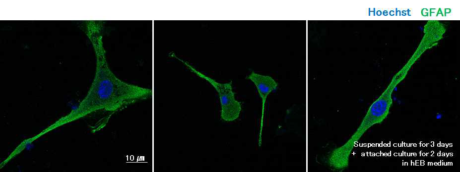신경분화마커의 2차 면역 염색법을 통해 탐지된 3차원 줄기세포 구성 세포의 모습 공초점형광현미경 사진