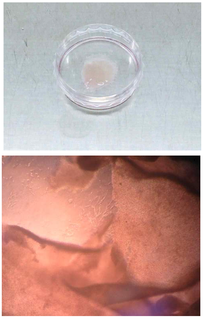 제조된 PNIPAAM 기반의 3층의 세포 시트 (C2C12) 이미지 (위), 제조된 세포 시트의 현미경 이미지 (아래)
