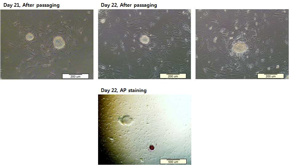 마우스 iPSCs의 새로운 feeder 위로 passaging 이후 광학현미경 사진과 AP staining 사진
