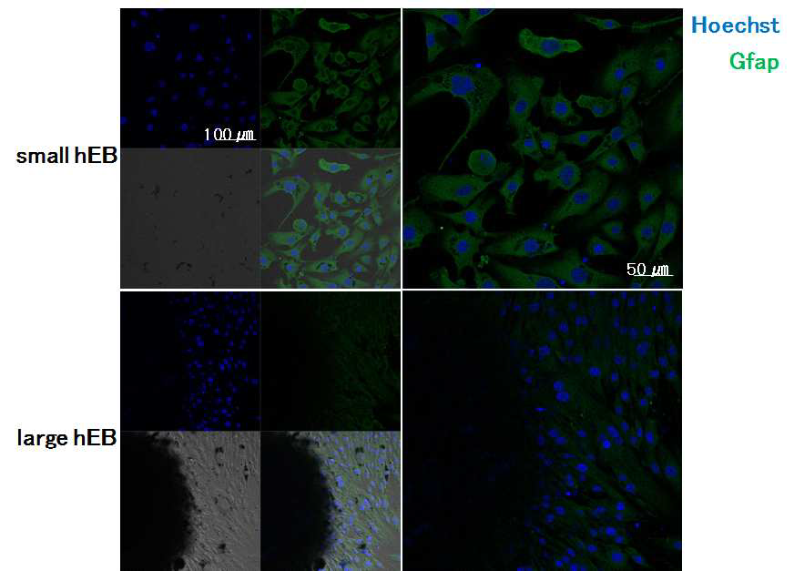 지름 300 um를 기준으로 작고 큰 3차원 줄기세포에서 외배엽성 분화 마커인 Gfap의 발현 레벨을 비교 분석한 2차 면역 염색법 공초점형광현미경(CLSM) 사진