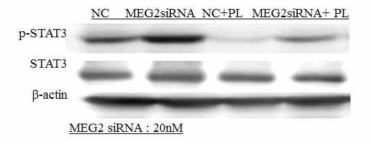 siRNA를 이용한 MEG2와 p-STAT3과의 상호 작용