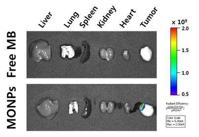 동물 질환 모델 (SKBR3, 유방암 모델)에 각각 Free MB (상)와 MONPs (하) 국소 주사 1시간 후 적출 장기 형광 이미징