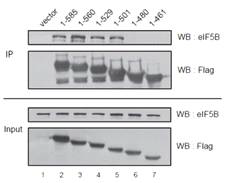 C말단으로부터 잘려진 형태의 eIF2A 중 1-480 아미노산부터 eIF5B와의 결합이 사라짐.