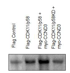 in vitro kinase assay를 통해 CDK11 p58이 eIF3f를 인산화 시킴을 확인함.