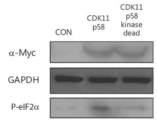 CDK11 p58의 wild 형태와 kinase dead 돌연변이 형태를 세포내 과발현한 뒤 eIF2 alpha의 인산화 정도를 비교한 결과 wild type의 CDK11 p58의 경우에 eIF2 alpha의 인산화가 증가함.