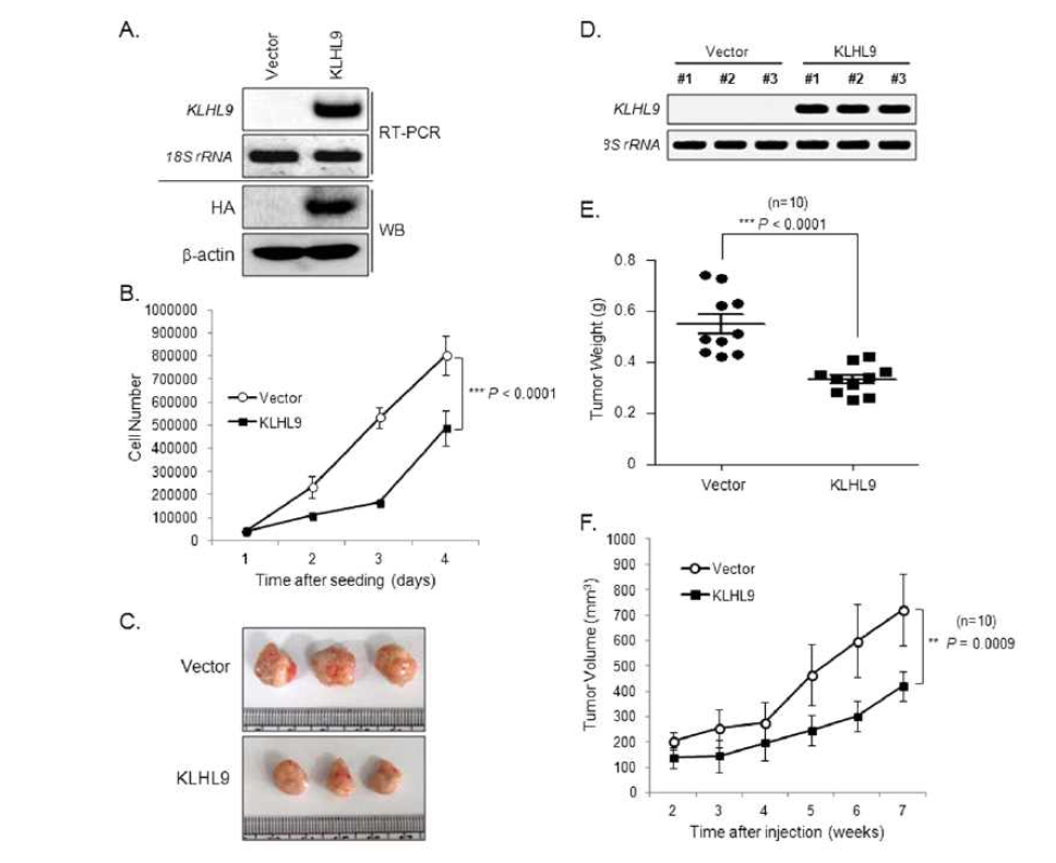 9p21 부위가 동형접합결실된 SNU-16 위암세포주에서 KLHL9 유전자 과 발현에 의한 세포성장 억제 및 종양형성 억제 능력 검증