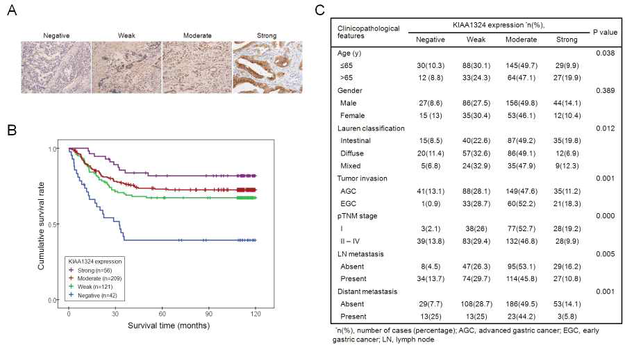 조직면역염색 분석을 통해 KIAA1324 단백질 발현과 위암환자의 예후와의 관계 확인.