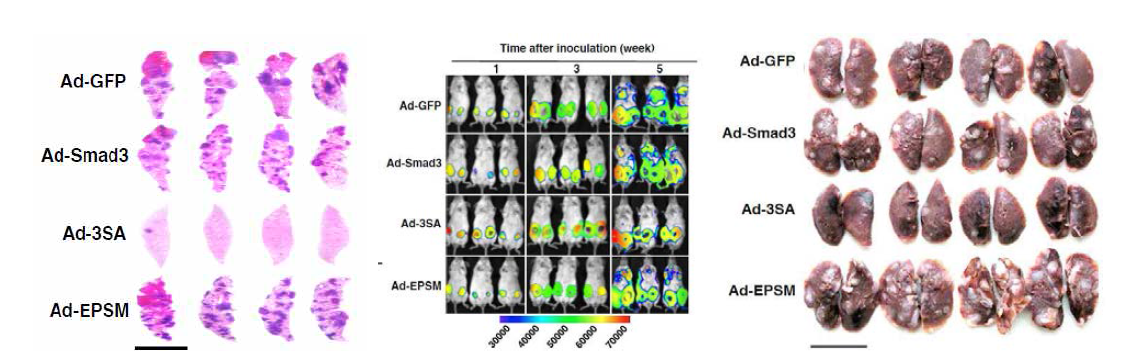 마우스 이종 이식 모델 및 전이 모델에서 확인된 Smad3 linker 인산화 불능을 통한 종양생성능 및 전이능 차이