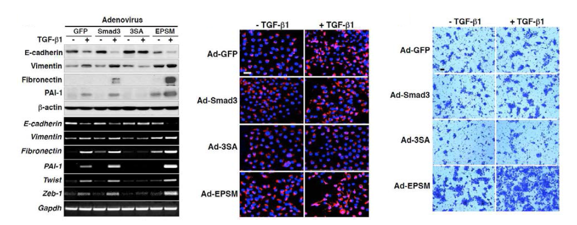 TGFbeta 에 의해 유도된 상피-간엽 전환 증가 현상과 유방암 세포 전이능을 증가 시키는 Smad3 linker 인산화 불능화 효과