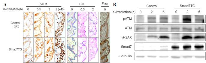 Smad7이 과발현된 마우스 피부세포에서 ATM과 H2AX의 활성이 X-방사선 처리 후 증가됨
