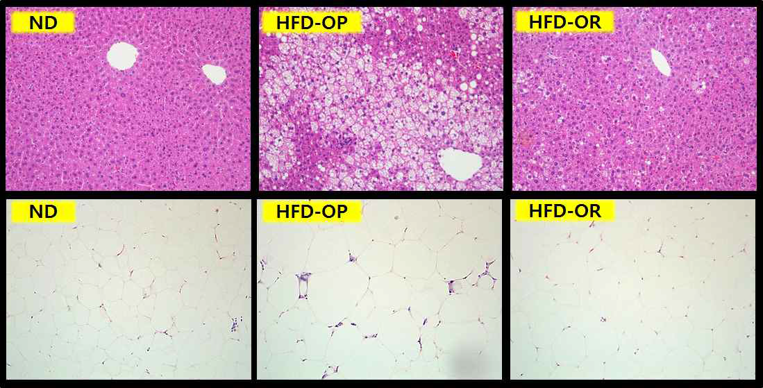 Hepatic and white adipose tissue morphology in obese-prone and obese-resistant C57BL/6J mice whose phenotype was observed after feeding high-fat diet for 12 weeks