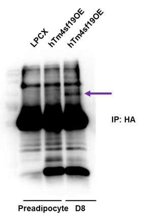 Tm4sf19 결합단백질 발굴
