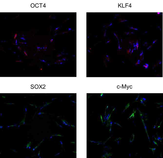 나노전달시스템을 이용하여 역분화인자(OCT4,KLF4, SOX2, c-Myc)의 전달가능성 확인실험