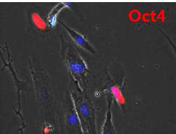 인간 태반 세포에서 나노 기술을 통해 전달된 역분화 인자 확인