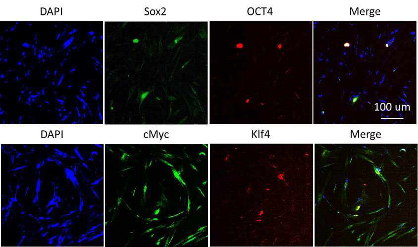 나노전달기술을 이용하여 역분화인자(OCT4, KLF4, SOX2, c-Myc)의 전달가능성 측정