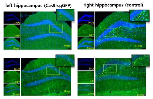 Hippocampus로 비삽입 sgGFP 렌티바이러스 주사 후 형광관찰