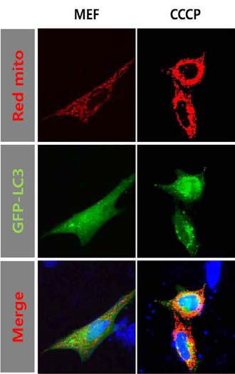 CCCP로 유도한 MEF세 포에서의 미토파지 관찰