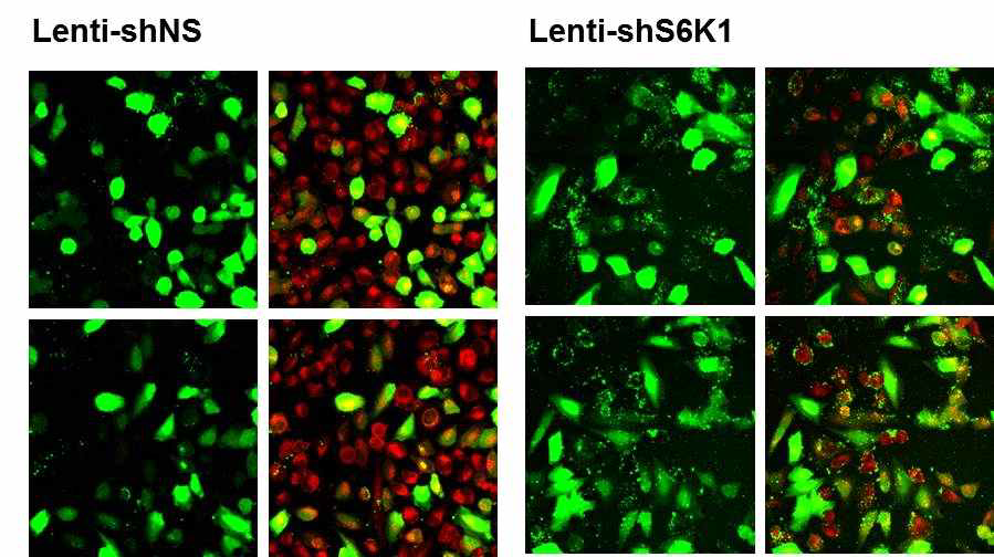 S6K1 발현 억제 시 자가포식의 증가. Green, GFP-LC3; pDsRed-Mito