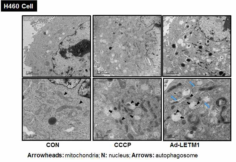 CCCP와 LETM1의 과발현에 의한 미토큰드리아의 형태변화와 잔재물 관찰