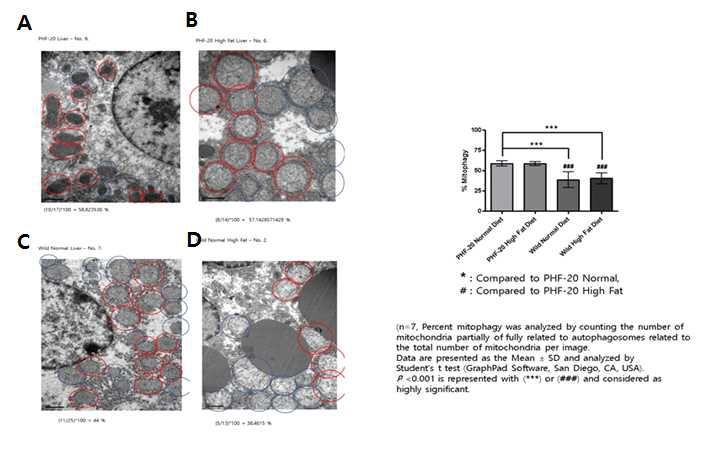 PHF20 Tg 마우스의 liver 조직에서의 TEM 분석