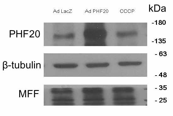 PHF20 과발현에 의한 fission 단백질인 MFF 변화