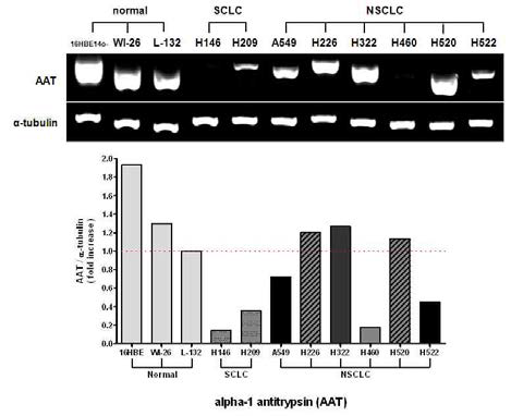 다양한 폐암세포주를 대상으로 alpha I-Antitrypsin (AAT)의 RNA 발현양 비교